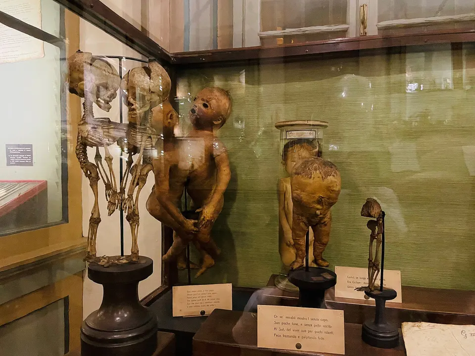 Pavia, al Museo per la Storia dell'Università la mostra su Camillo Golgi